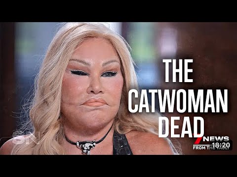 Jocelyn Wildenstein dead at 82, Here are some of her last moments Before death.