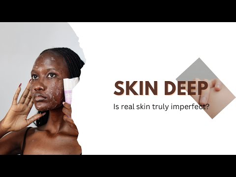 I filmed 4 amazing black women with different skin issues and this is the result