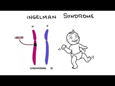 Angelman Syndrome