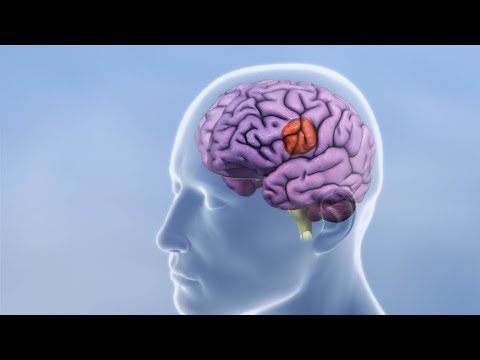 Breakthrough in the fight against glioblastoma