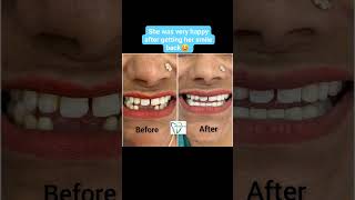 #DentalHealth#OralCare#SmileMakeover#TeethWhitening#DentalTips#OralHealth#DentalHygiene#CosmeticDent