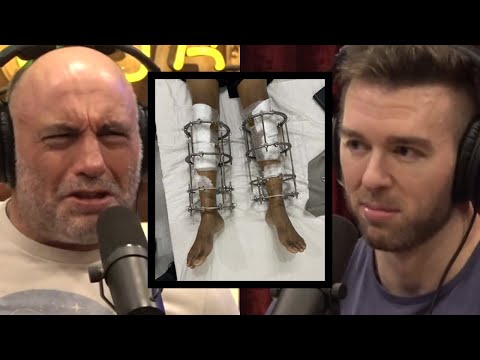 Leg Lengthening: The Price of Perfection or Just Plain Madness? | Joe Rogan & Derek MPMD