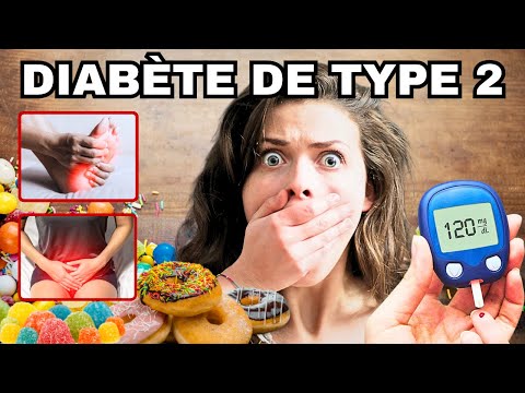 SYMPTÔMES les plus fréquents du DIABETE de type 2 à connaître