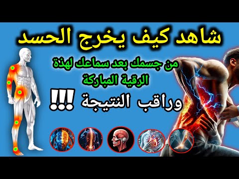 🔴 رقية الشفاء الشرعية - تخلص من السحر والمس والعين بآيات القرآن الكريم,syeh alaa yasser