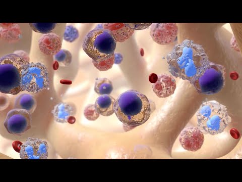 Leukemia Treatments