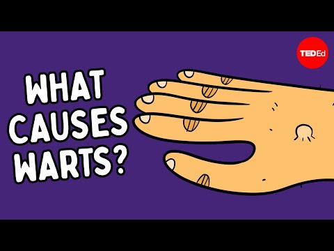 What are warts — and how do you get rid of them? - Cella Wright