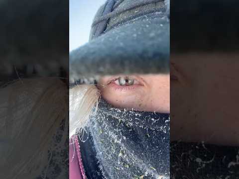 -20 = eyelash icicles