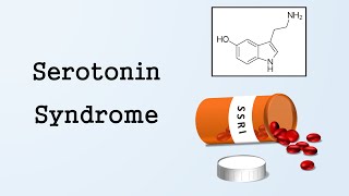 Serotonin Syndrome