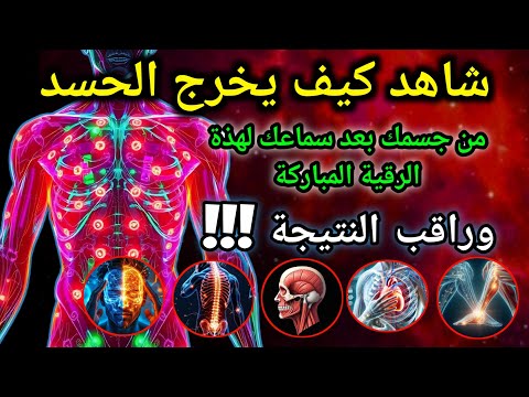 الرقية الشرعية للشفاء العاجل | آيات قرآنية لطرد السحر والعين والمس"aql