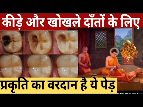 सड़े गले दांतों को ठीक कैसे करे | Home Remedies to cure tooth cavity and infection