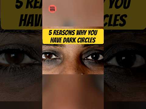 Dark Circles: The Reasons You Have Them!