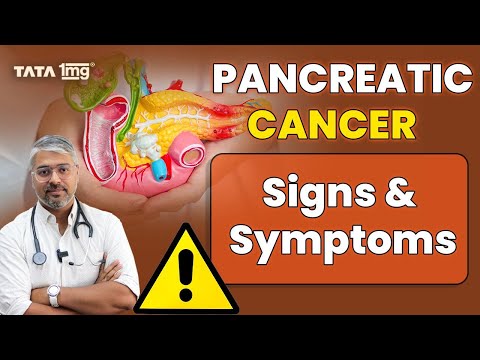 Pancreatic cancer | Signs & symptoms