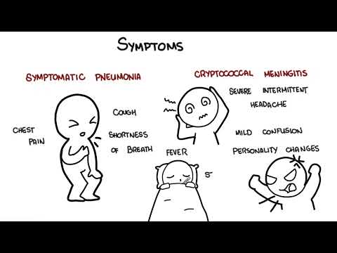 Cryptococcus neoformans infection - symptoms, pathophysiology, diagnosis, treatment