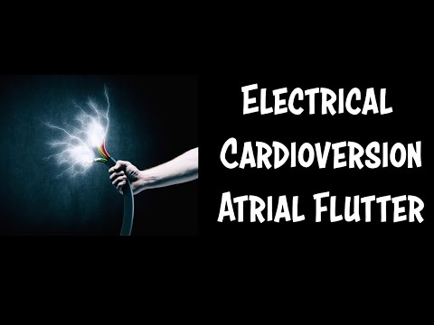 Emergency Cardioversion of Atrial Flutter