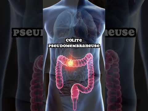 La bactérie Clostridium difficile ne s’appelle plus ainsi ! @LinExplain #bacteria #diarrhea #colite