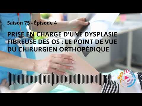 Prise en charge d’une Dysplasie Fibreuse des Os : le point de vue du chirurgien orthopédique