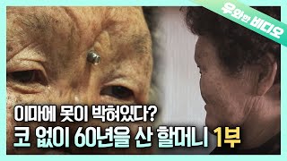 코가 함몰된 할머니, 미간에 못이 박혀있는 이유는?┃The Reason Why She Has a Nail In her Forehead