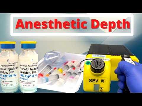 "I'll be asleep, right?" - Discussing anesthetic depth with patients