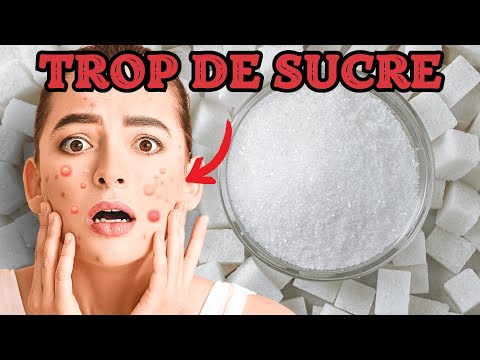 8 SIGNES que tu manges TROP DE SUCRE