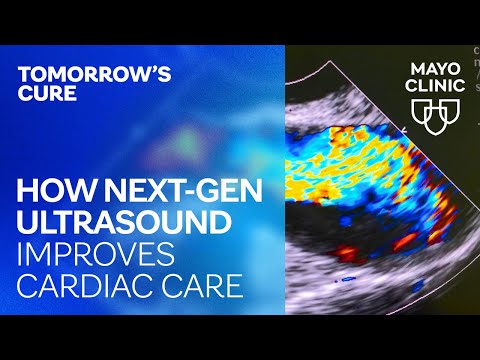 How Next-Gen Ultrasound Improves Cardiac Care | Tomorrow's Cure Season 2 Episode 6