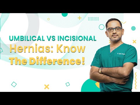 Umbilical vs incisional Hernia : Know the Difference | Mykare Health