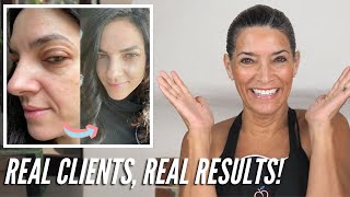 All Natural Anti-Aging Skin Transformation! | Natural Skincare Routines