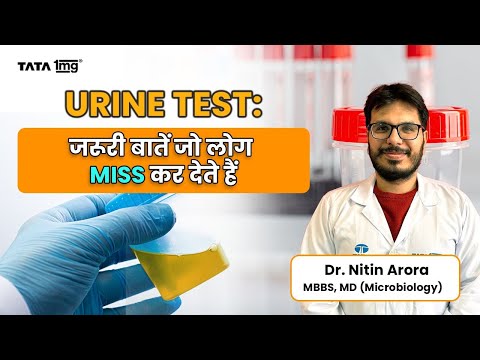 Urine Test FAQs: What to Expect & How to Prepare