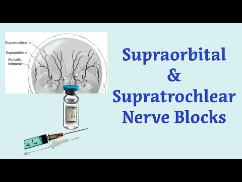 Anesthesia Technique for Blocking the Supraorbital and Supratrochlear Nerves