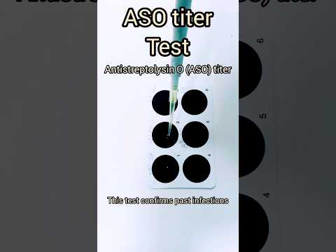 ASO titer test  #shorts #short