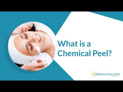 What is a Chemical Peel?