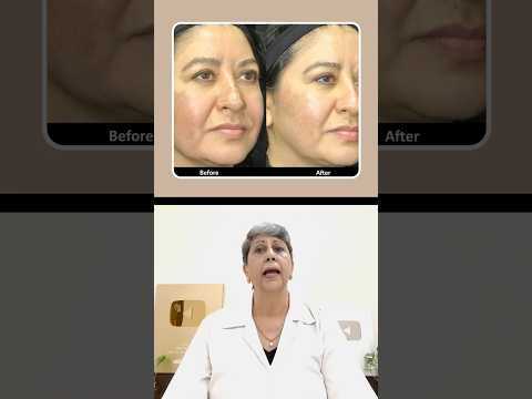 Niacinamide - Very useful skin care vitamin || त्वचा के लिए बहुत ही लाभकारी विटामिन