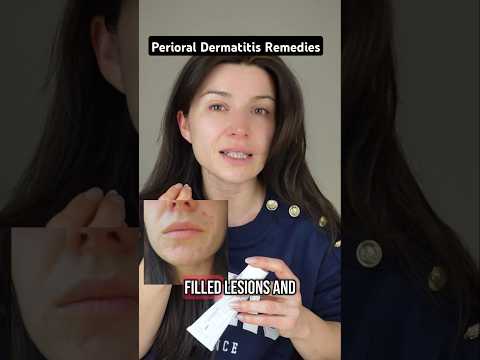 How I got rid of my Perioral Dermatitis naturally