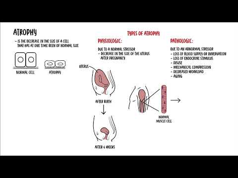 Cellular Adaptation - hyperplasia, hypertrophy, atrophy and metaplasia + cell injury