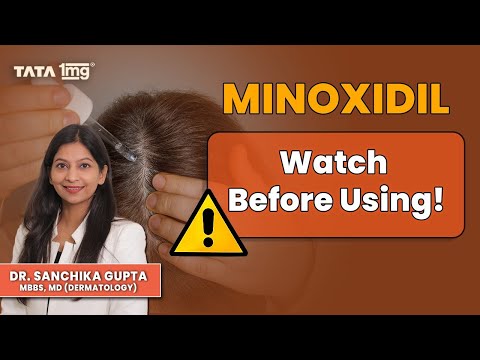 Minoxidil: Shocking Side Effects No One Talks About