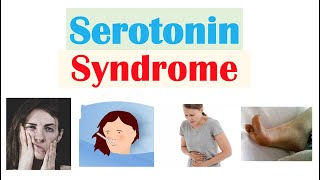 Serotonin Syndrome | Causes (Medications), Pathophysiology, Signs & Symptoms, Diagnosis, Treatment