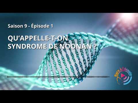 Qu’appelle-t-on syndrome de Noonan ?