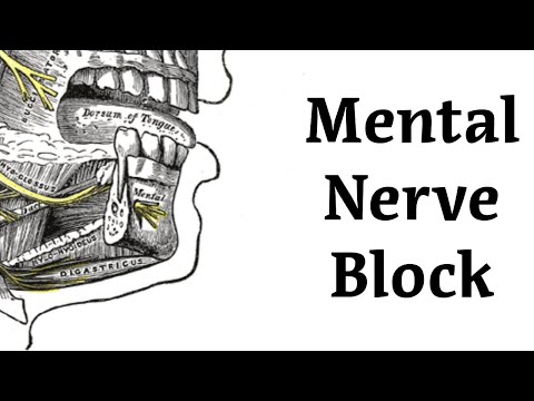 Mental Nerve Block Procedure