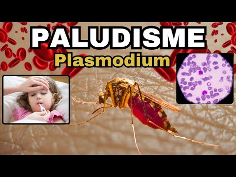 Tout savoir sur le PALUDISME - MALARIA : Plasmodium, Cycle, Diagnostic, Traitement