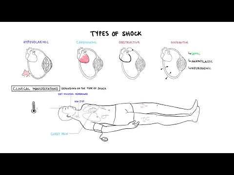 Approach to Shock - types, hypovolemic, cardiogenic, distributive, anaphylaxis, pathology, treatment