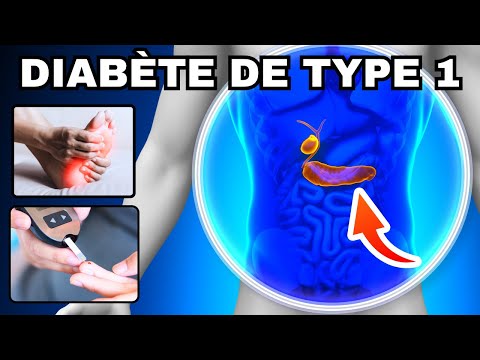 SYMPTÔMES les plus fréquents du DIABETE de type 1 à connaître