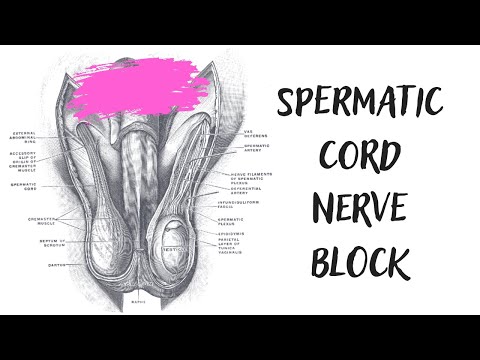 Spermatic Cord Nerve Block