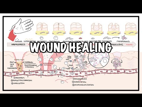 Wound Healing - Stages of healing and pathology