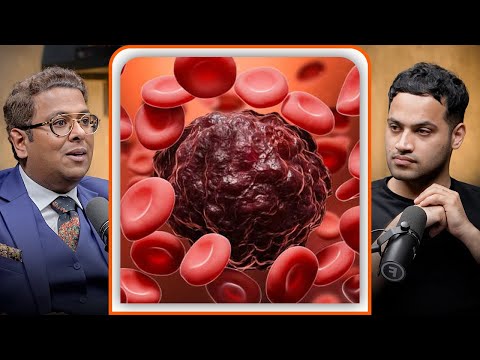 This Cancer Won’t Show Any Symptoms – Do These Tests NOW! – Dr Tarang Krishna | Raj Shamani Clips