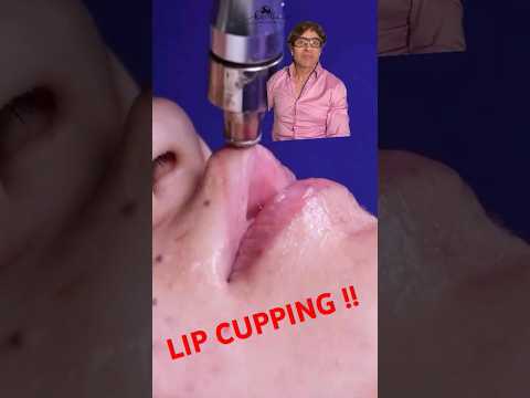 Lip Cupping // All Natural Lip Plumping  !!