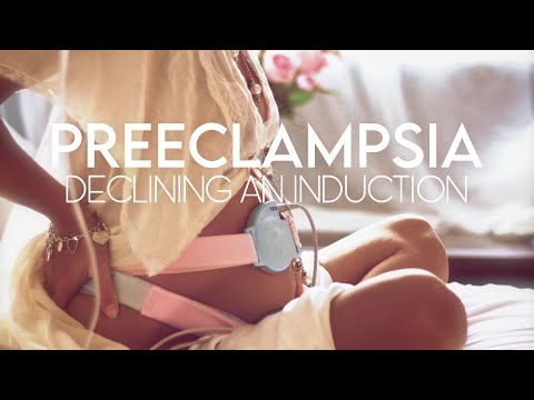 Preeclampsia: declining an induction (skit)