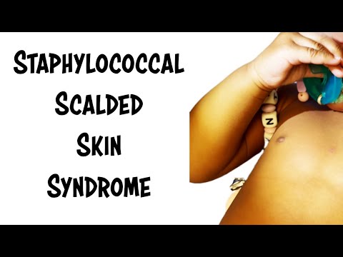 Staphylococcal Scalded Skin Syndrome