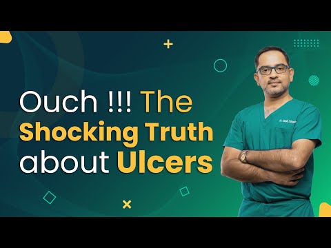 Ouch The Shocking Truth about Ulcers | Mykare Health