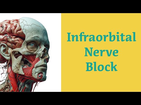 Infraorbital Nerve Block Procedure