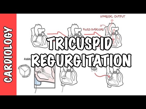 Tricuspid Regurgitation pathophysiology, investigation and treatment