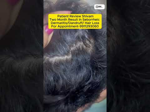 Expert Tips to Regrow Hair & Prevent Hair Loss Fast